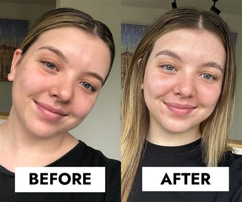r/beforevsafter|Beforevsafter .